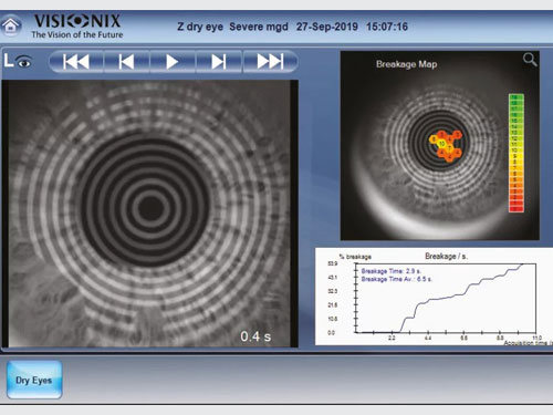 occhio secco servizi